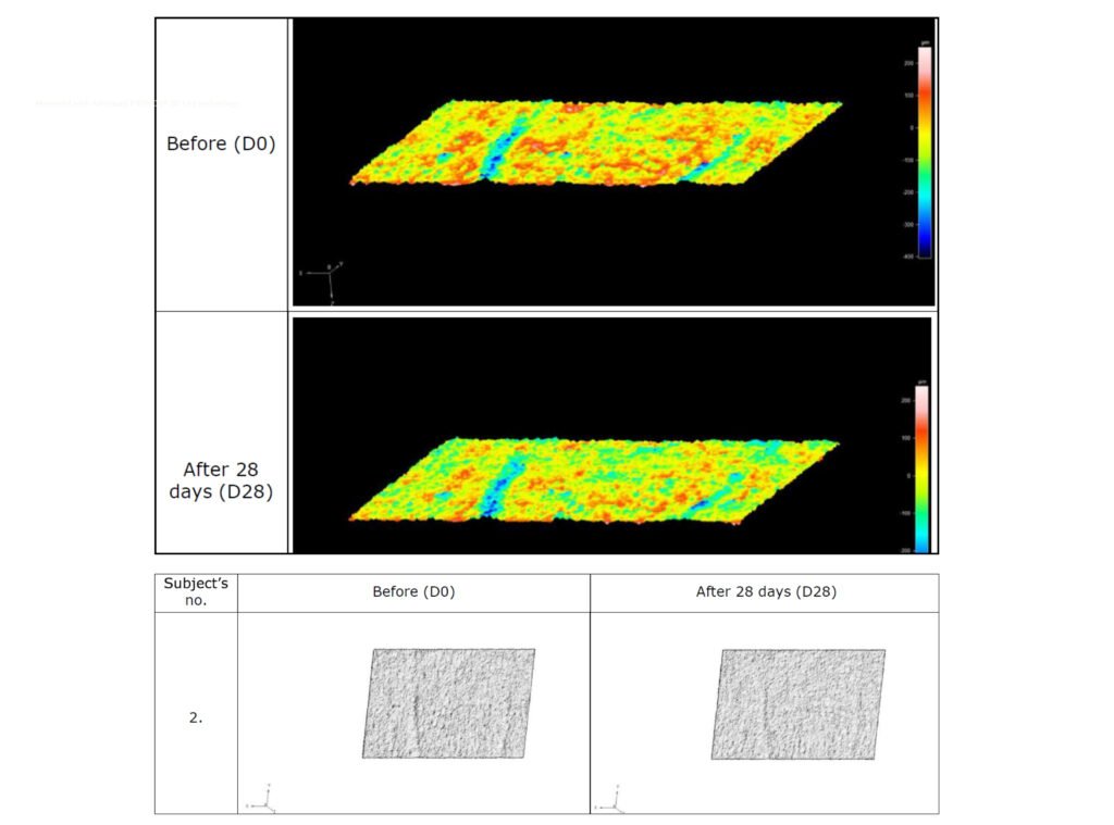 PRIMOS® 3D Lite topography maps showing reduction of wrinkle count, depth, length, area and volume after 28 days of Daily Bloom serum, demonstrating measurable improvement in skin surface structure.